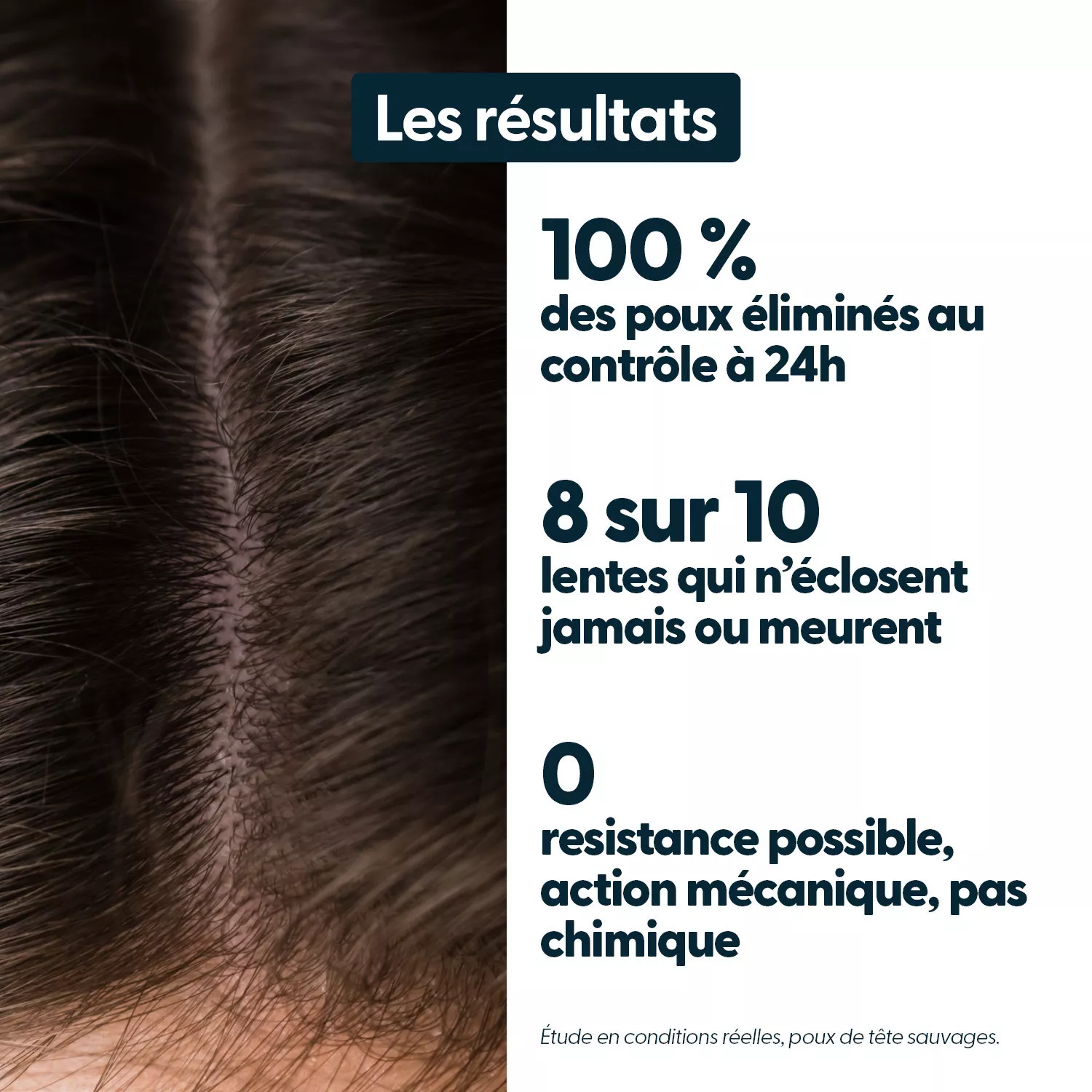 ActiPoux - Spray Anti Poux & Lentes